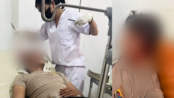 Kedua anggota polisi yang terkena lemparan batu massa aksi mengalami luka pada bagian kepala (ist)