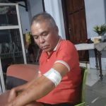 Korban saat ditemui dirumahnya dengan luka yang masih dibalut perban (yandry/kupangterkini.com)