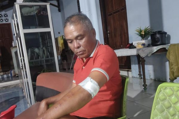 Korban saat ditemui dirumahnya dengan luka yang masih dibalut perban (yandry/kupangterkini.com)