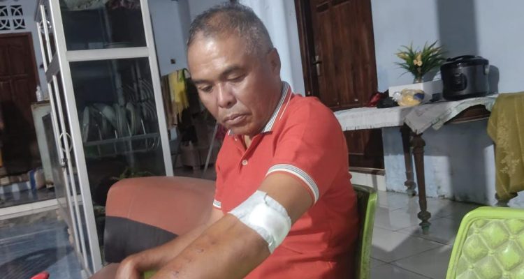 Korban saat ditemui dirumahnya dengan luka yang masih dibalut perban (yandry/kupangterkini.com) Korban saat ditemui dirumahnya dengan luka yang masih dibalut perban (yandry/kupangterkini.com)