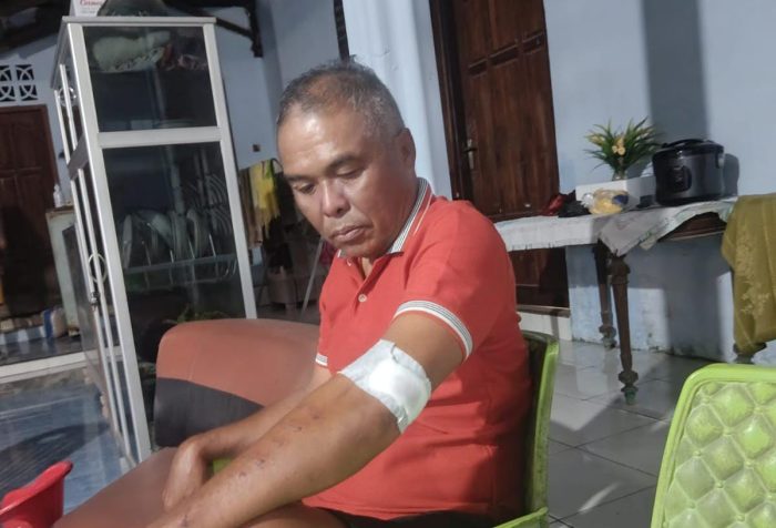 Korban saat ditemui dirumahnya dengan luka yang masih dibalut perban (yandry/kupangterkini.com)